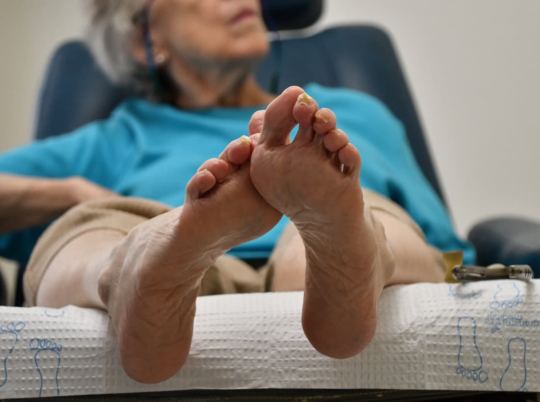 Consecuencia de la edad en los pies